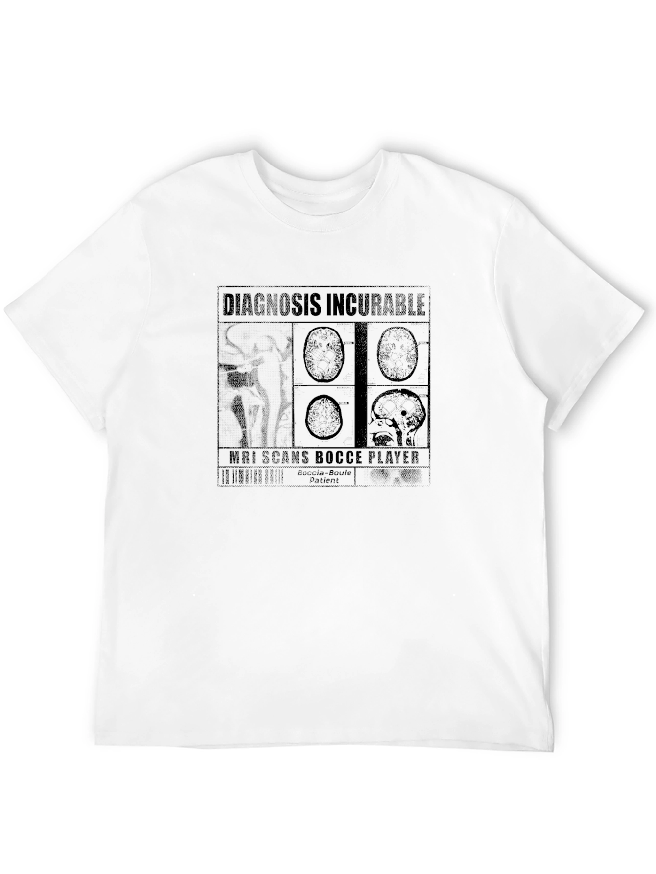 Diagnosis Incurable Bocce Player T-Shirt - Black
